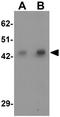 Adaptor Related Protein Complex 3 Subunit Mu 1 antibody, GTX32019, GeneTex, Western Blot image 