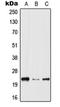 Hematopoietic Prostaglandin D Synthase antibody, orb215136, Biorbyt, Western Blot image 