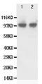 FGFR-2 antibody, PA1241, Boster Biological Technology, Western Blot image 