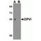 Platelet glycoprotein VI antibody, TA306633, Origene, Western Blot image 
