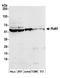 Ro60, Y RNA Binding Protein antibody, A303-693A, Bethyl Labs, Western Blot image 