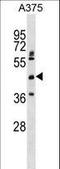 Aspartate Beta-Hydroxylase Domain Containing 2 antibody, LS-C159134, Lifespan Biosciences, Western Blot image 
