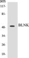 BLNK antibody, EKC1063, Boster Biological Technology, Western Blot image 