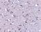 Sodium/hydrogen exchanger 1 antibody, 4377, ProSci, Western Blot image 