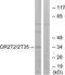 Olfactory Receptor Family 2 Subfamily T Member 2 antibody, PA5-38223, Invitrogen Antibodies, Western Blot image 