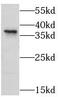 Phospholipid Phosphatase Related 2 antibody, FNab04836, FineTest, Western Blot image 