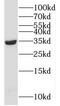 Coiled-Coil Domain Containing 189 antibody, FNab01039, FineTest, Western Blot image 