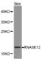 Ribonuclease A Family Member 12 (Inactive) antibody, MBS127360, MyBioSource, Western Blot image 