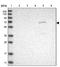 POB1 antibody, NBP1-80891, Novus Biologicals, Western Blot image 
