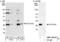 Casein kinase II subunit beta antibody, NBP1-06515, Novus Biologicals, Western Blot image 