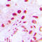 DNA repair protein RAD51 homolog 4 antibody, LS-C368490, Lifespan Biosciences, Immunohistochemistry paraffin image 