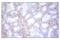Zinc Finger E-Box Binding Homeobox 1 antibody, 70512S, Cell Signaling Technology, Immunohistochemistry paraffin image 