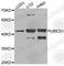 Ubiquitin Conjugating Enzyme E2 U antibody, A8376, ABclonal Technology, Western Blot image 