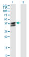 Pyruvate Dehydrogenase E1 Beta Subunit antibody, LS-C133369, Lifespan Biosciences, Western Blot image 