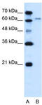 Solute carrier family 15 member 4 antibody, TA333497, Origene, Western Blot image 