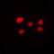 Vacuolar Protein Sorting 72 Homolog antibody, LS-C368637, Lifespan Biosciences, Immunofluorescence image 