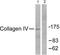 Collagen Type IV Alpha 1 Chain antibody, TA311650, Origene, Western Blot image 