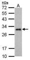 Lin-28 Homolog A antibody, NBP2-43673, Novus Biologicals, Western Blot image 