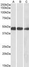Isocitrate Dehydrogenase (NADP(+)) 2, Mitochondrial antibody, PA5-19412, Invitrogen Antibodies, Western Blot image 