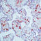Coagulation factor XIII A chain antibody, LS-C87630, Lifespan Biosciences, Immunohistochemistry frozen image 