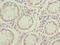 Fatty Acid Binding Protein 1 antibody, A54672-100, Epigentek, Immunohistochemistry paraffin image 