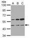 3-Oxoacyl-ACP Synthase, Mitochondrial antibody, GTX123464, GeneTex, Western Blot image 
