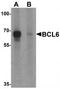 BCL6 Transcription Repressor antibody, TA319620, Origene, Western Blot image 