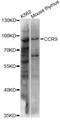C-C Motif Chemokine Receptor 9 antibody, LS-C749831, Lifespan Biosciences, Western Blot image 