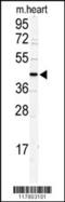 DNA Replication And Sister Chromatid Cohesion 1 antibody, 61-567, ProSci, Western Blot image 