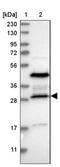 Ribosomal RNA Processing 15 Homolog antibody, NBP1-84522, Novus Biologicals, Western Blot image 