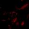 Claudin 5 antibody, NBP2-02259, Novus Biologicals, Immunocytochemistry image 