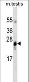 Glutathione S-Transferase Alpha 1 antibody, LS-C159793, Lifespan Biosciences, Western Blot image 