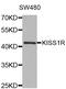 KiSS-1 receptor antibody, MBS127430, MyBioSource, Western Blot image 