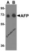 Alpha Fetoprotein antibody, 5869, ProSci, Western Blot image 