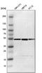 Proteasome 26S Subunit, ATPase 4 antibody, PA5-51676, Invitrogen Antibodies, Western Blot image 