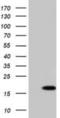 Chromosome 10 Open Reading Frame 82 antibody, NBP2-02828, Novus Biologicals, Western Blot image 