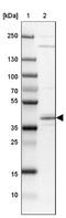 Stearoyl-CoA Desaturase 5 antibody, NBP1-89274, Novus Biologicals, Western Blot image 
