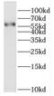 Hepatic And Glial Cell Adhesion Molecule antibody, FNab03830, FineTest, Western Blot image 