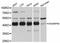 SHANK Associated RH Domain Interactor antibody, A12240, ABclonal Technology, Western Blot image 