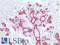 Keratin 8 antibody, LS-B16077, Lifespan Biosciences, Immunohistochemistry paraffin image 