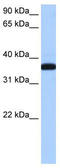 Exoribonuclease 1 antibody, TA344013, Origene, Western Blot image 