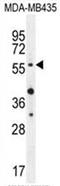 Protein kinase B antibody, AP50136PU-N, Origene, Western Blot image 