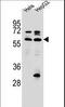 Selenoprotein N antibody, LS-C168964, Lifespan Biosciences, Western Blot image 