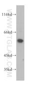 Diacylglycerol Kinase Epsilon antibody, 11900-1-AP, Proteintech Group, Western Blot image 