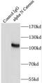 Catenin alpha-2 antibody, FNab00331, FineTest, Immunoprecipitation image 