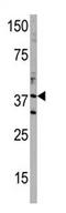 DIMT1 RRNA Methyltransferase And Ribosome Maturation Factor antibody, AP11762PU-N, Origene, Western Blot image 