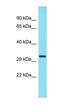 TSR3 Ribosome Maturation Factor antibody, orb326856, Biorbyt, Western Blot image 