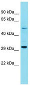 Family With Sequence Similarity 185 Member A antibody, TA335892, Origene, Western Blot image 