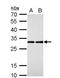 Ribosomal Protein L7a antibody, NBP2-20217, Novus Biologicals, Western Blot image 