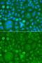 Laforin antibody, orb373524, Biorbyt, Immunofluorescence image 